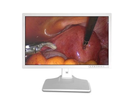 Medizinische endoskopische Zusätze zeigen 32inch an