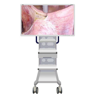 Medizinische Endoscope-Monitor-Kamera mit Schirm 55inch