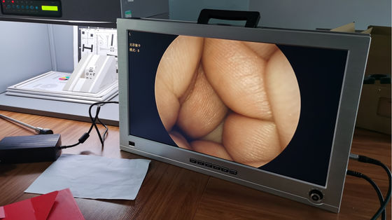 Der 22 Zoll-Monitor integrierte den vollen tragbaren HD-Endoscope-Kamera-System-HNOsatz