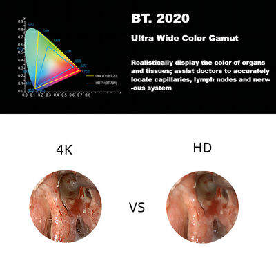 Endoscope-Kamera-System Dez 3840A neues 4K ultra HD medizinisches für Laparoskopie